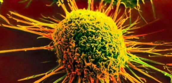 Now you can name a new cancer drug after you. Only £1m